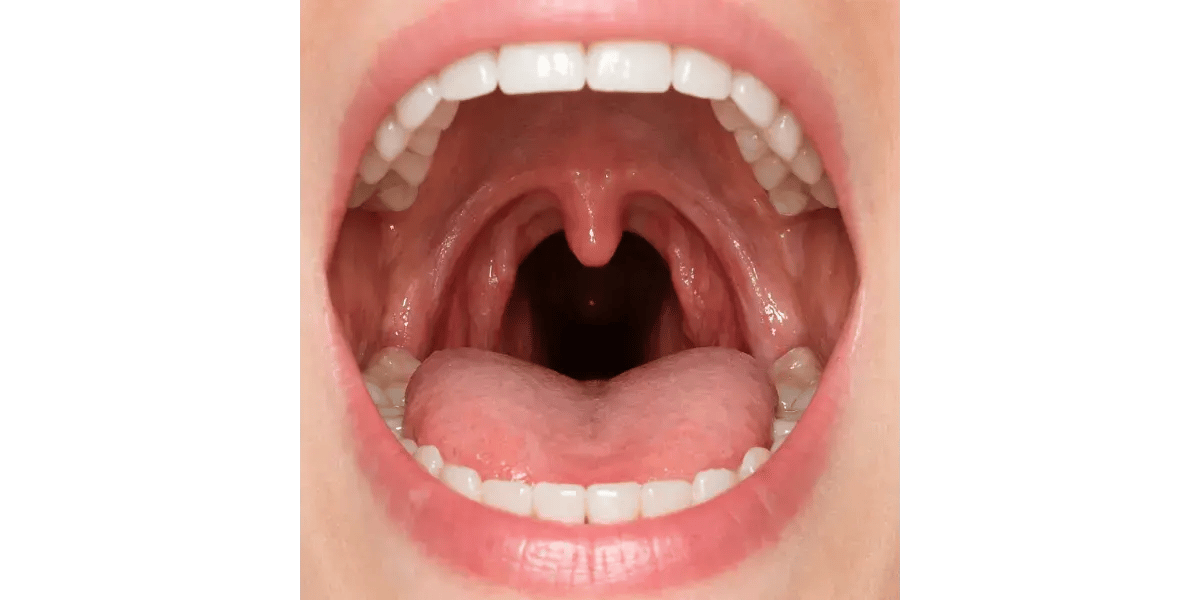 A close-up of a wide-open mouth showing a relaxed throat, illustrating the concept of singing without vocal constriction.