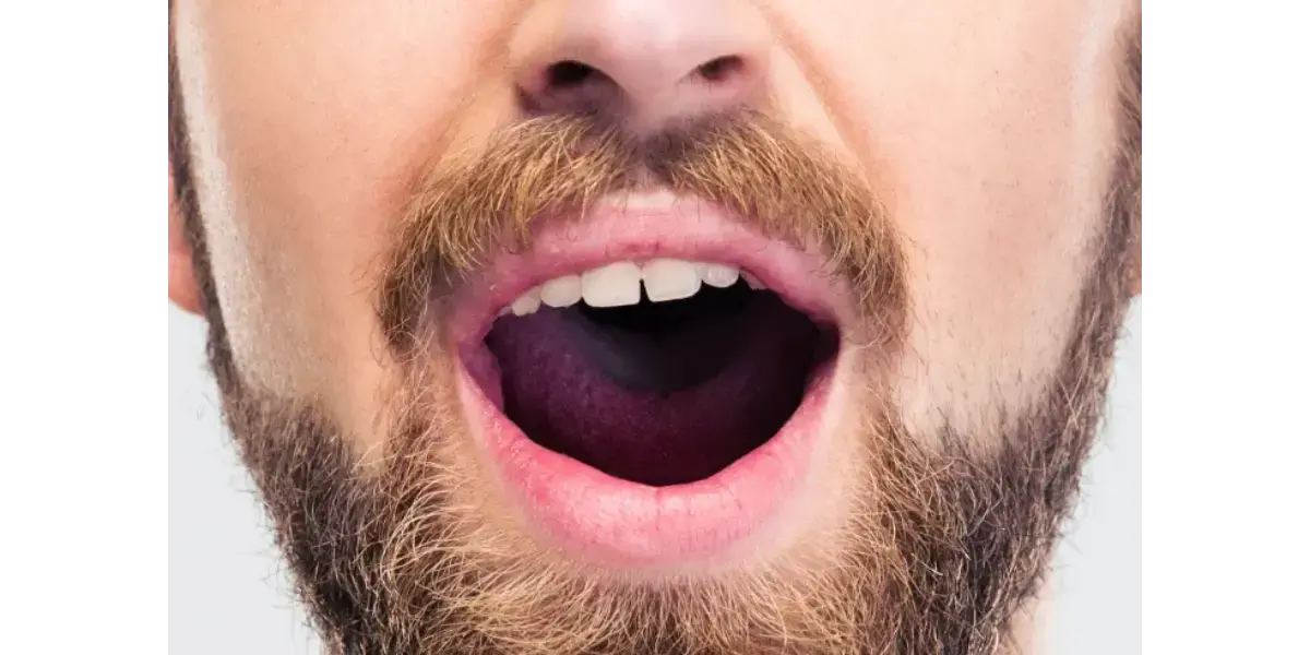 Singing With Excessive Volume (Too Loud)