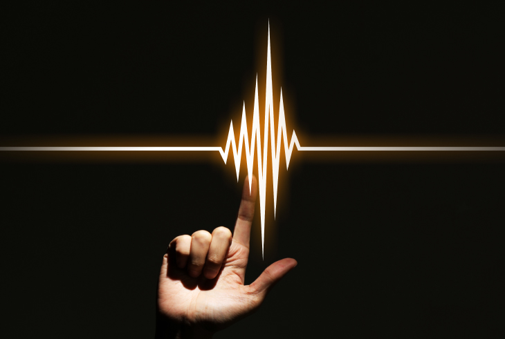 Lack of rhythm or pulse