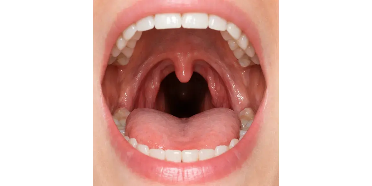 Seeking Open Throat – No Constriction, Please